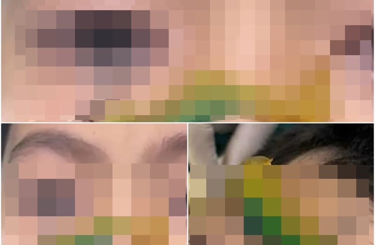 Ảnh oche: Cân nhắc khi xem