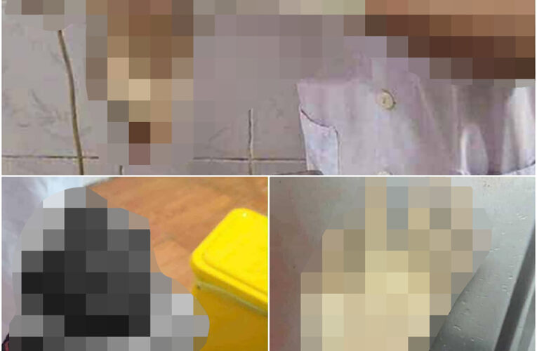 Ảnh 0che: Thanh niên bị che’m li`a ba`n tay